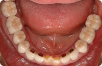 Case1_After_3