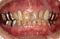 Case1_Before_1
