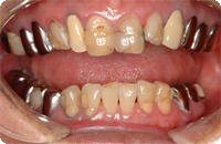 Case1_Before_2