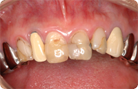Case1_Before_3