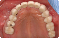 Case2_After_3