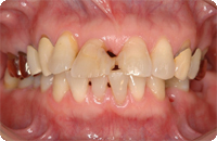 Case2_Before_1