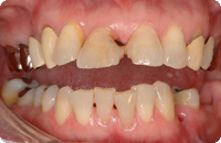 Case2_Before_2