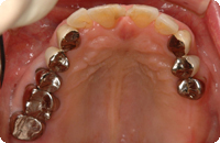 Case2_Before_3