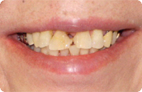 Case2_Before_4