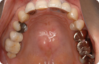Case3_Before_3