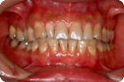 Case1_Before