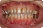 Case2_Before