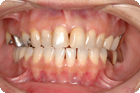 Case2_After